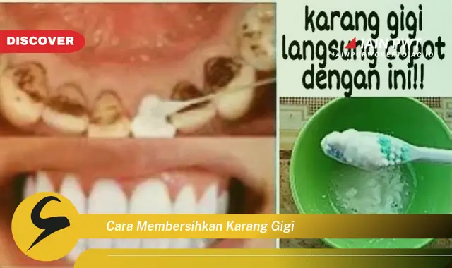 cara membersihkan karang gigi