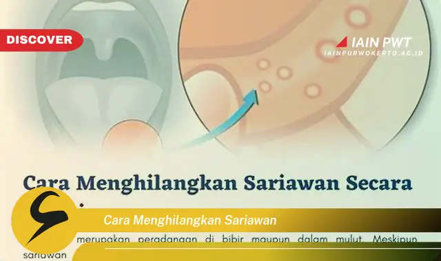 cara menghilangkan sariawan