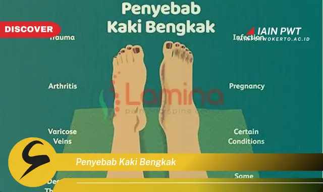 penyebab kaki bengkak