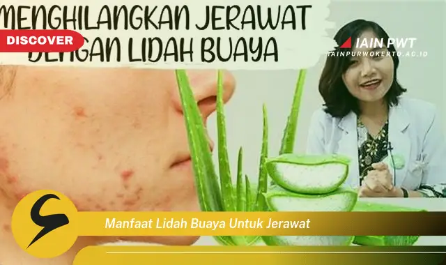 manfaat lidah buaya untuk jerawat