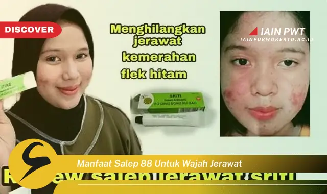 manfaat salep 88 untuk wajah jerawat