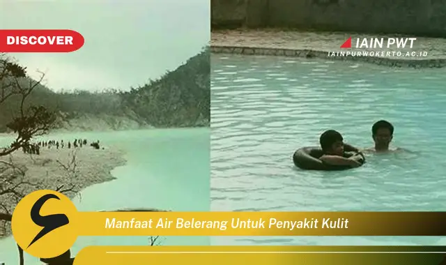 manfaat air belerang untuk penyakit kulit